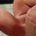 Quase 50% dos bairros da capital tem índices altos de dengue
