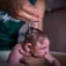 Microcefalia em Goiás já foi confirmada em 9 casos (Foto: EPA)