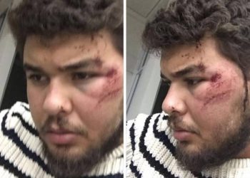 Motorista de Uber mostra marcas da agressão cometida por taxista (Foto: Reprodução)
