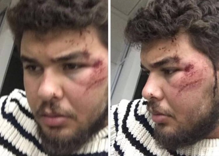 Motorista de Uber mostra marcas da agressão cometida por taxista (Foto: Reprodução)
