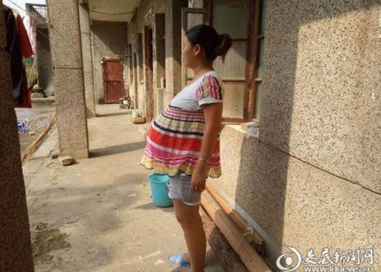 Mulher disse que está há 17 meses esperando o feto |Foto: Reprodução: People’s Daily