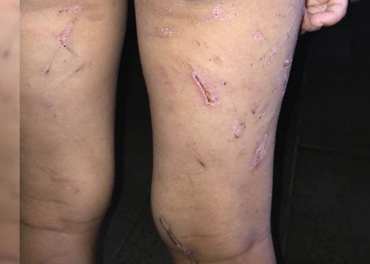 Criança era vítima de tortura, surra com fios e castigos em Niquelândia | Foto: Divulgação/ Polícia Civil