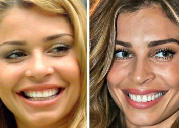 Veja tudo o que precisa saber antes de colocar facetas dentárias em Goiânia. A atriz Grazi Massafera já passou pelo procedimento| Foto: Reprodução