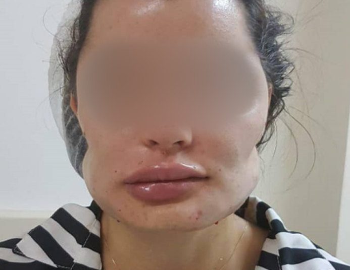 Cremego diz que vai apurar denúncias contra cirurgião plástico de Goiânia | Foto: Reprodução