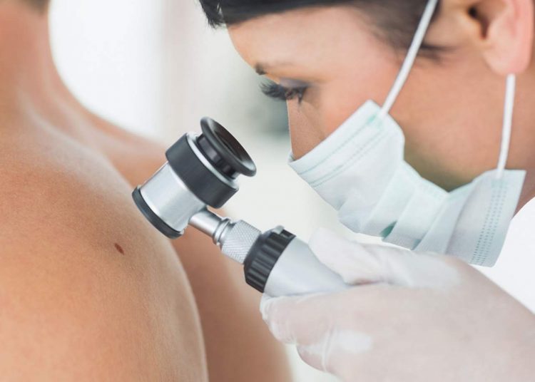 Consulta dermatológica gratuita será oferecida no HDT neste sábado, 15 | Foto: Ilustração