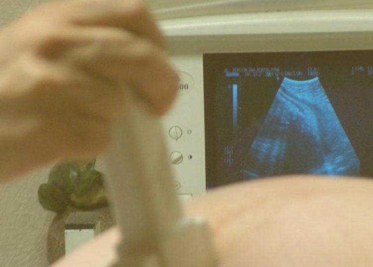 Exames ultrassom Goiânia