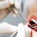 atendimentos odontológicos gratuitos