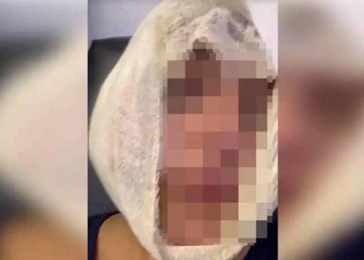 Homem é suspeito de atirar copo no rosto da cunhada em Aparecida | Foto: Reprodução / Mais Goiás