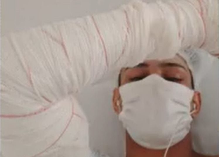 homem corta braço direito Goiânia