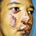 Jovem é espancado e perde grande parte dos dentes em Goiânia | Foto: Reprodução