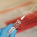Teste para novo coronavírus - Crédito: Horth Rasur/ Shutterstock