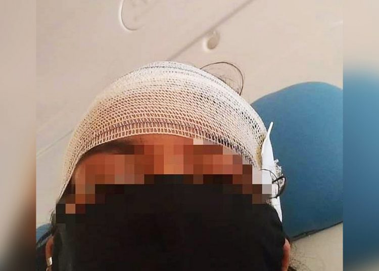 Aluna foi esfaqueada em Goiânia | Foto: Reprodução