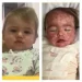 A pequena Helena após reação a remédio receitado por médico | Foto: Reprodução