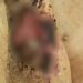 Idoso tinha larvas em feridas pelo corpo | Foto: Reprodução
