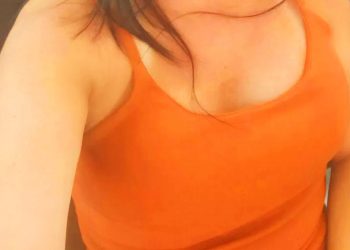 Mulher denuncia que perdeu parte dos seios após cirurgia plástica | Foto: Arquivo Pessoal