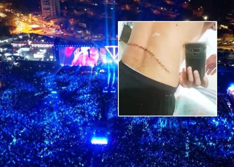 Jovem levou mais de 20 pontos na ferida e foi liberado pela equipe média para se recuperar em casa | Fotomontagem: divulgação