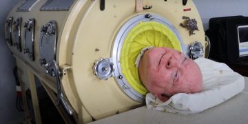 Através de técnicas respiratórias e com ajuda da máquina, Paul conseguiu recuperar parte de sua 'normalidade' | Foto: Reprodução/Youtube