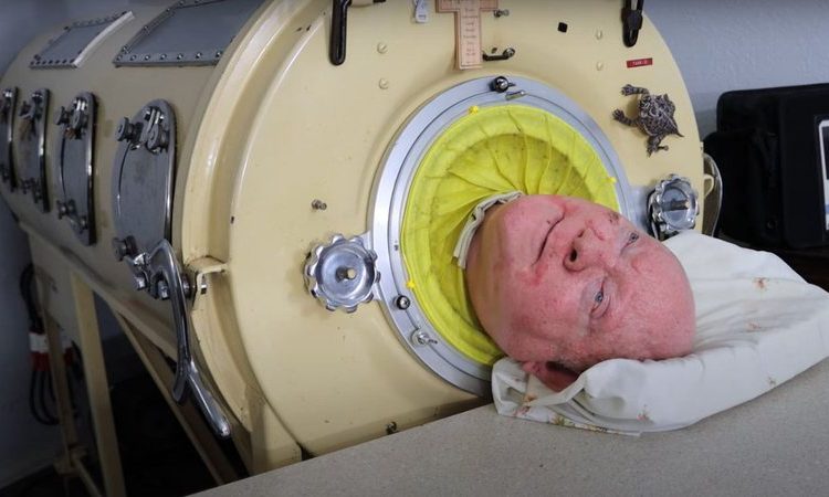Através de técnicas respiratórias e com ajuda da máquina, Paul conseguiu recuperar parte de sua 'normalidade' | Foto: Reprodução/Youtube