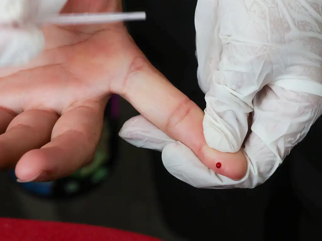 Aparecida registra 1,7 mil casos de HIV em 4 anos: veja onde fazer o teste